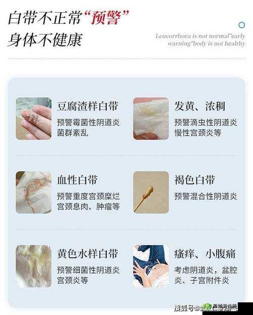 女生次数多了会有豆腐渣分泌物吗:原因及应对