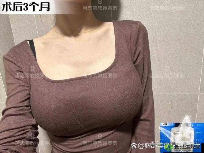 d 女郎丰胸真的有效果吗?其效果究竟如何探究