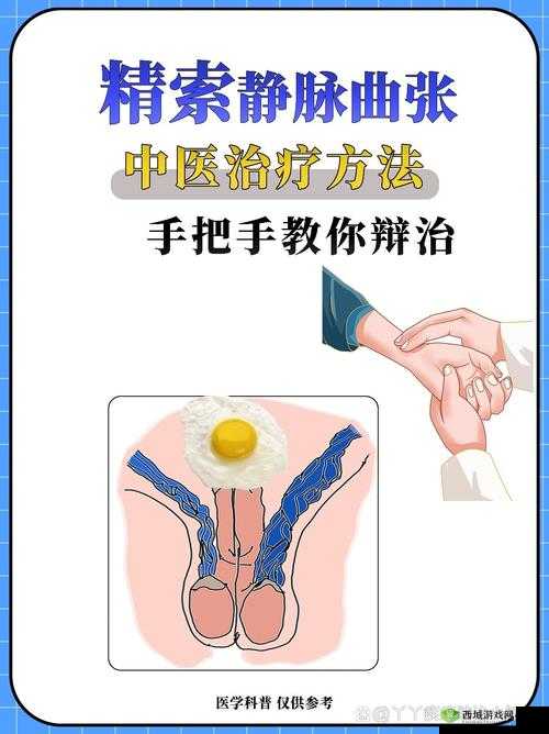胡桃夹精索静脉曲张能治好吗:探寻其治疗的可能性与方法